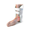 Orthèse stabilisatrice de cheville Aircast Classique II - XS - Gauche -