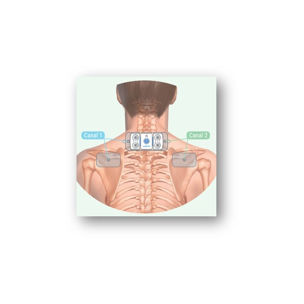 Electrode multisite ActiTENS