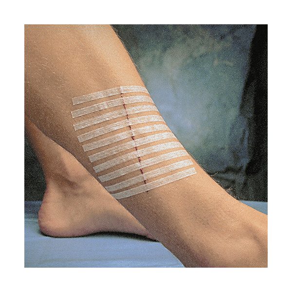 Suture cutanée adhésive Steri-Strip 38 x 6 mm