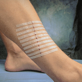 Suture cutanée adhésive Steri-Strip 38 x 6 mm