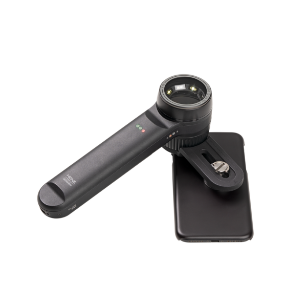 Adaptateur smartphone universel pour dermatoscope