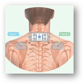 Electrode multisite ActiTENS