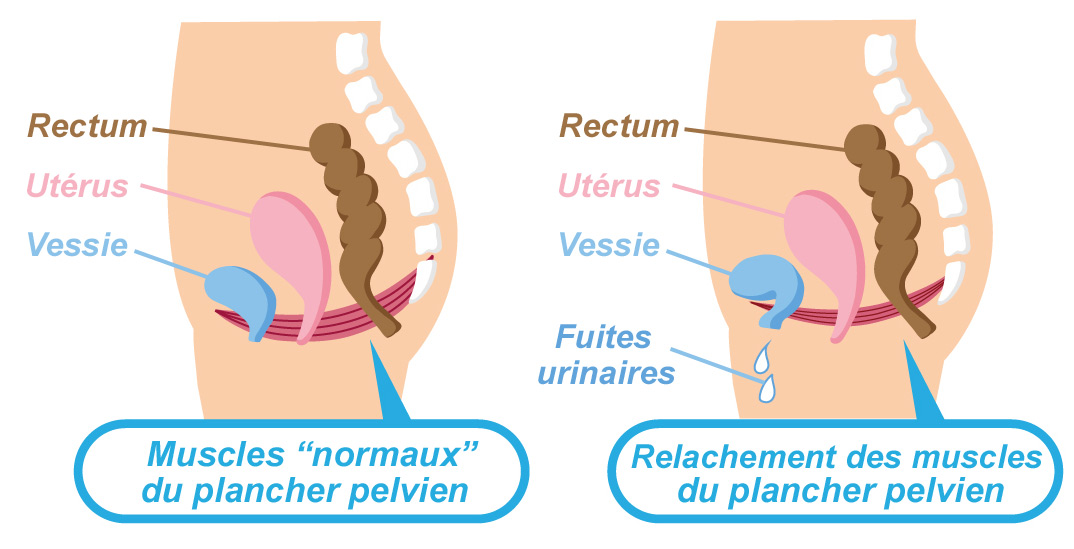 Relâchement muscles plancher pelvien